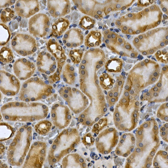 STAT3 Rabbit pAb