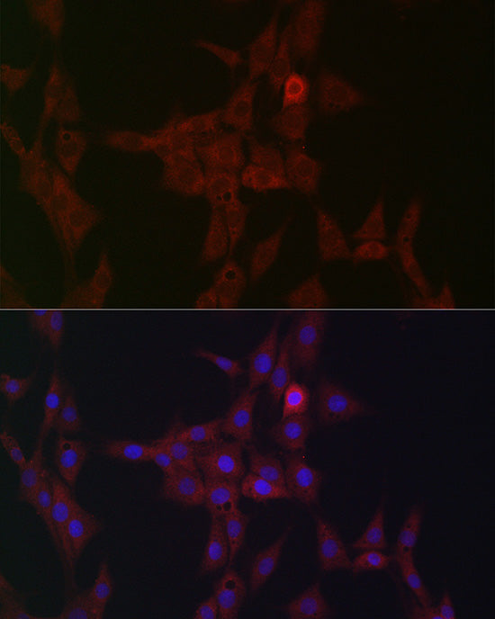 STAT3 Rabbit pAb