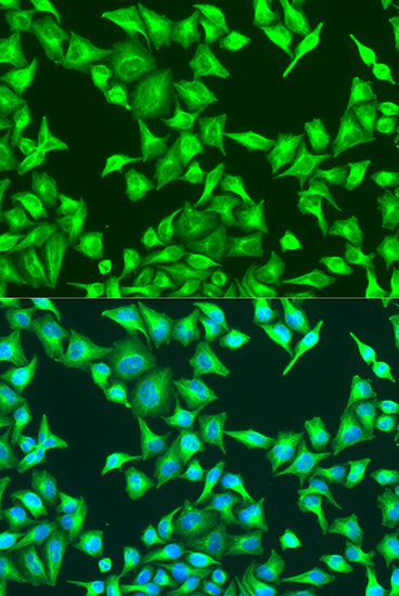 β-Catenin Rabbit pAb