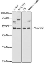 [KD Validated] Vimentin Rabbit pAb