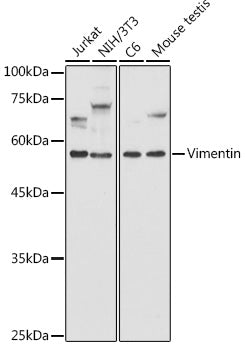 [KD Validated] Vimentin Rabbit pAb