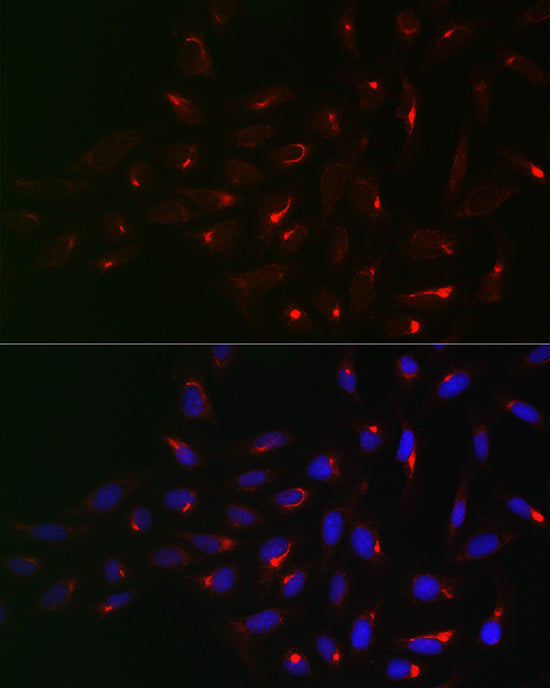 [KD Validated] Vimentin Rabbit pAb