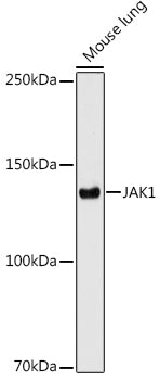 JAK1 Rabbit mAb