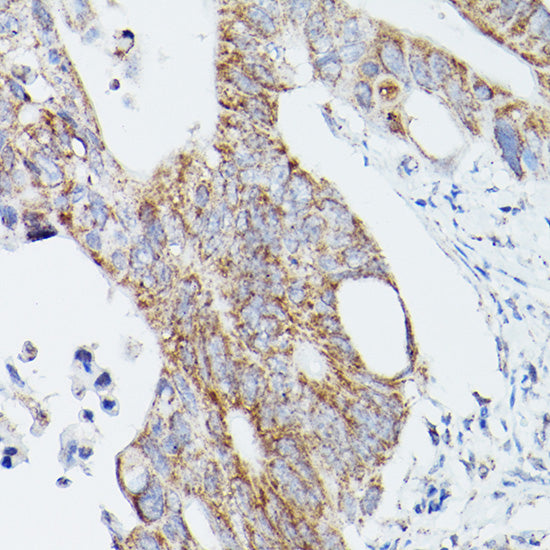 ATG16L1 Rabbit pAb