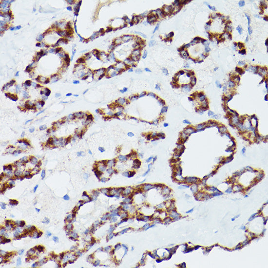 ATG16L1 Rabbit pAb