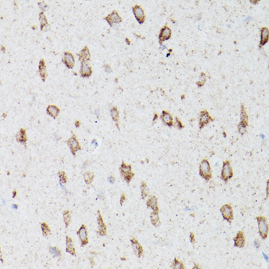 ATG16L1 Rabbit pAb