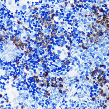 S100A8 Rabbit mAb