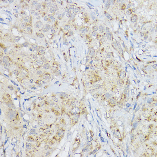 MMP3 Rabbit pAb