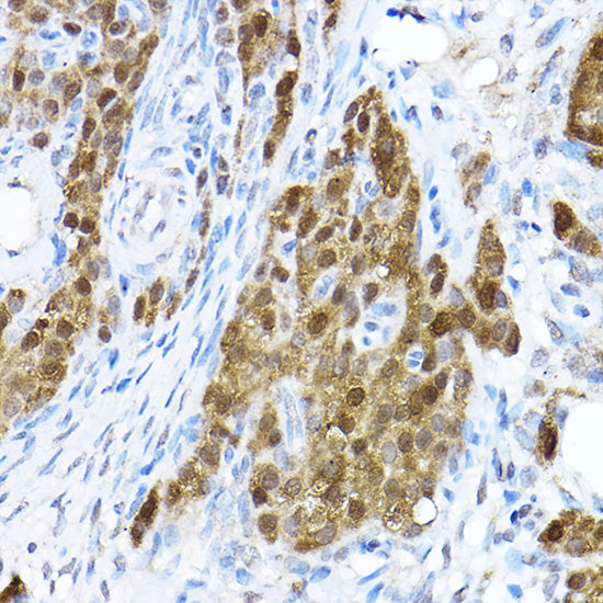 STAT1 Rabbit pAb