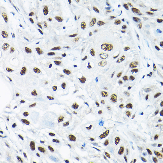 SNRPA1 Rabbit pAb