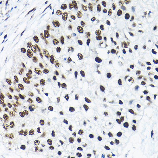SNRPA1 Rabbit pAb