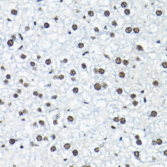 SNRPA1 Rabbit pAb