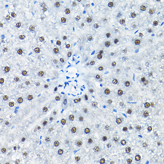 SNRPA1 Rabbit pAb