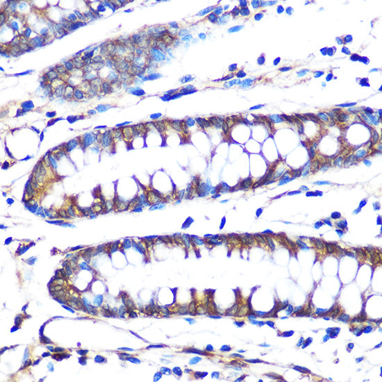 Aromatase (CYP19A1) Rabbit mAb