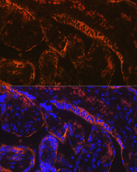 Aromatase (CYP19A1) Rabbit mAb