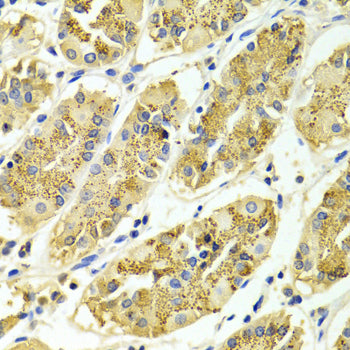 ARHGAP25 Rabbit pAb