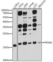 PFDN2 Rabbit pAb