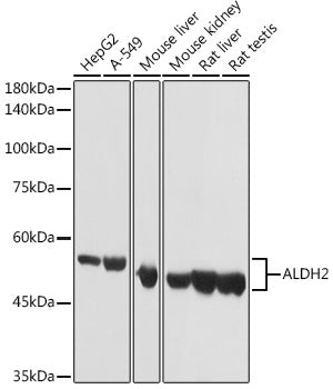 ALDH2 Rabbit pAb