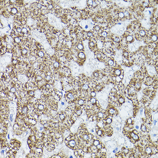 ALDH2 Rabbit pAb