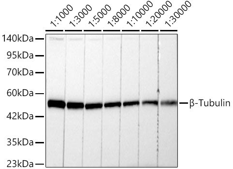 β-Tubulin Rabbit mAb