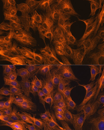 β-Tubulin Rabbit mAb