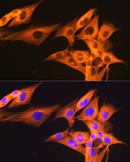 β-Tubulin Rabbit mAb