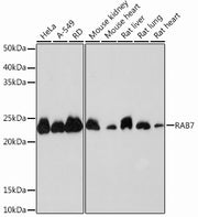 RAB7 Rabbit mAb