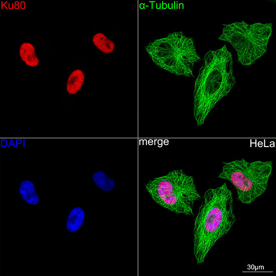 Ku80 Rabbit mAb