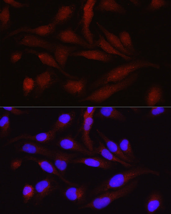 PGC1α Rabbit pAb
