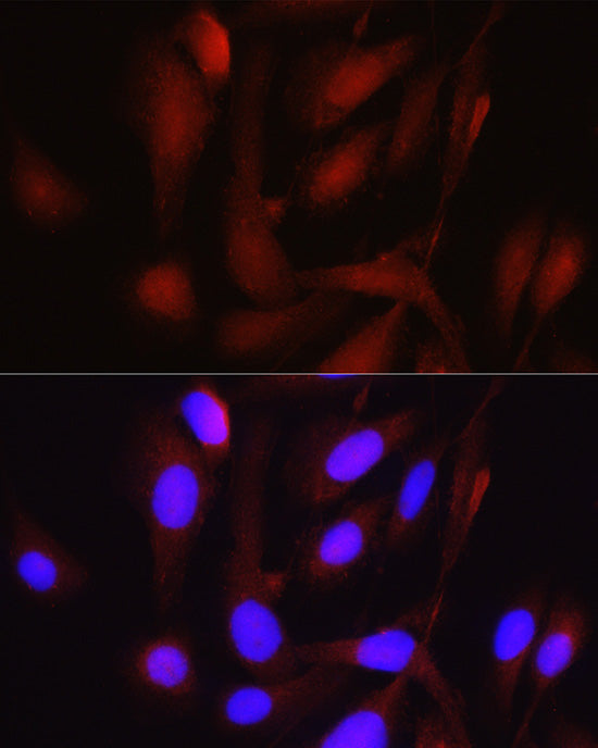PGC1α Rabbit pAb