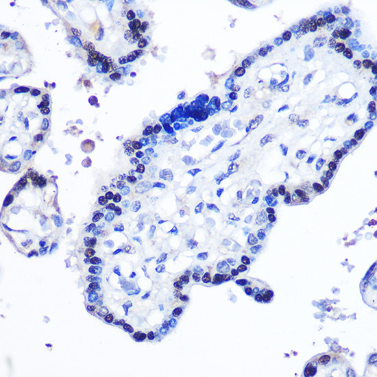 STAT5B Rabbit pAb