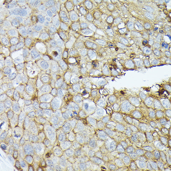 CD138/Syndecan-1 Rabbit pAb