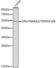 DR5/TRAILR2/TNFRSF10B Rabbit pAb