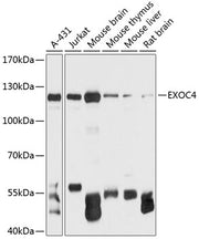 EXOC4 Rabbit pAb