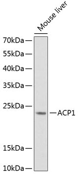 ACP1 Rabbit pAb