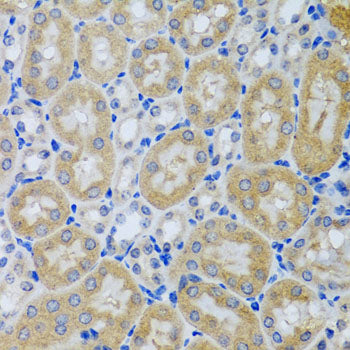 ACP1 Rabbit pAb