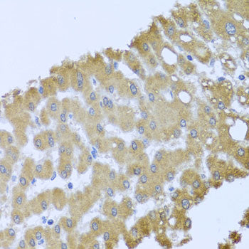 ACP1 Rabbit pAb