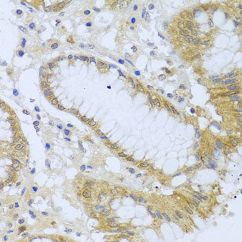 ACP1 Rabbit pAb