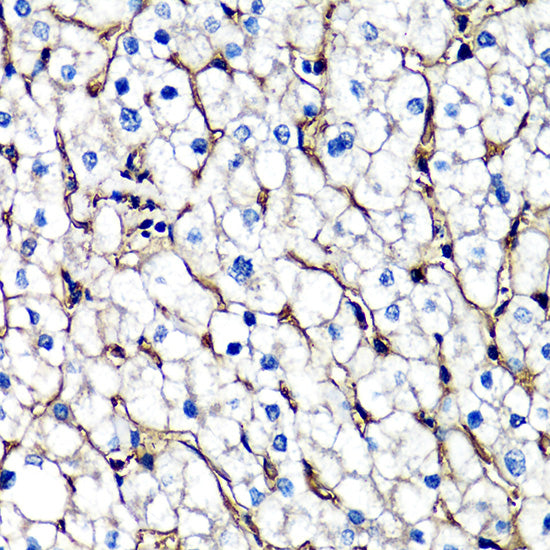 beta 2 Microglobulin Rabbit pAb
