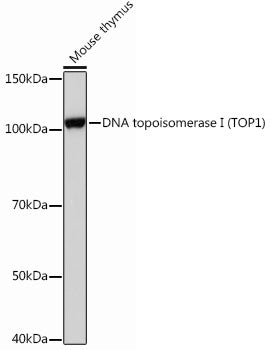 DNA topoisomerase I (TOP1) Rabbit mAb