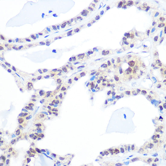 DNA topoisomerase I (TOP1) Rabbit mAb