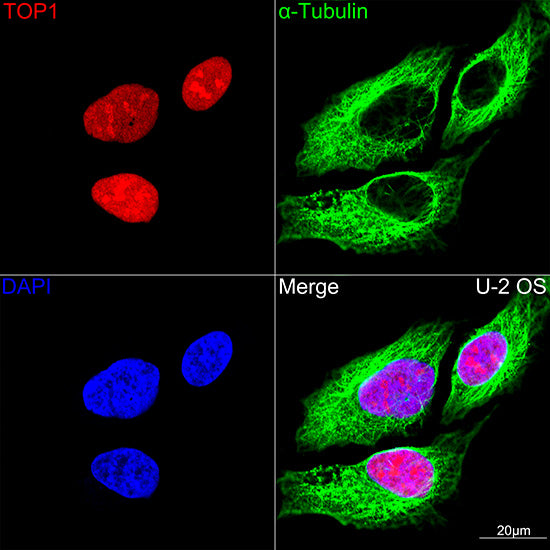 DNA topoisomerase I (TOP1) Rabbit mAb