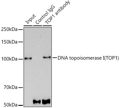 DNA topoisomerase I (TOP1) Rabbit mAb