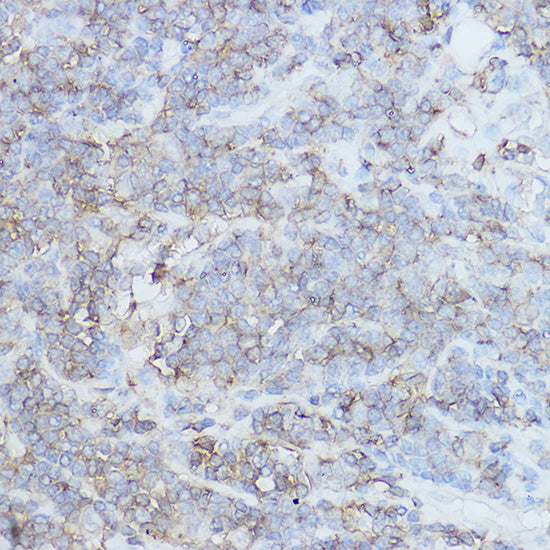[KO Validated] CD44 Rabbit pAb
