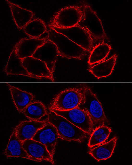 [KO Validated] CD44 Rabbit pAb