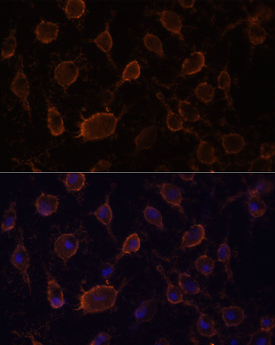 [KO Validated] CD44 Rabbit pAb