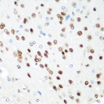 CDK1 Rabbit pAb