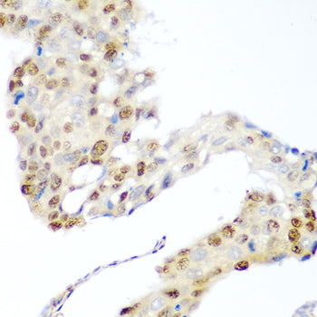 CDK1 Rabbit pAb