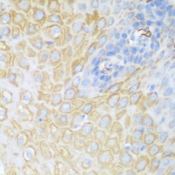 CDK1 Rabbit pAb