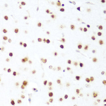 CDK1 Rabbit pAb